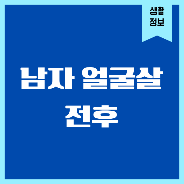 남자 얼굴살 전후 직접 겪어보니 완전 달라졌어요